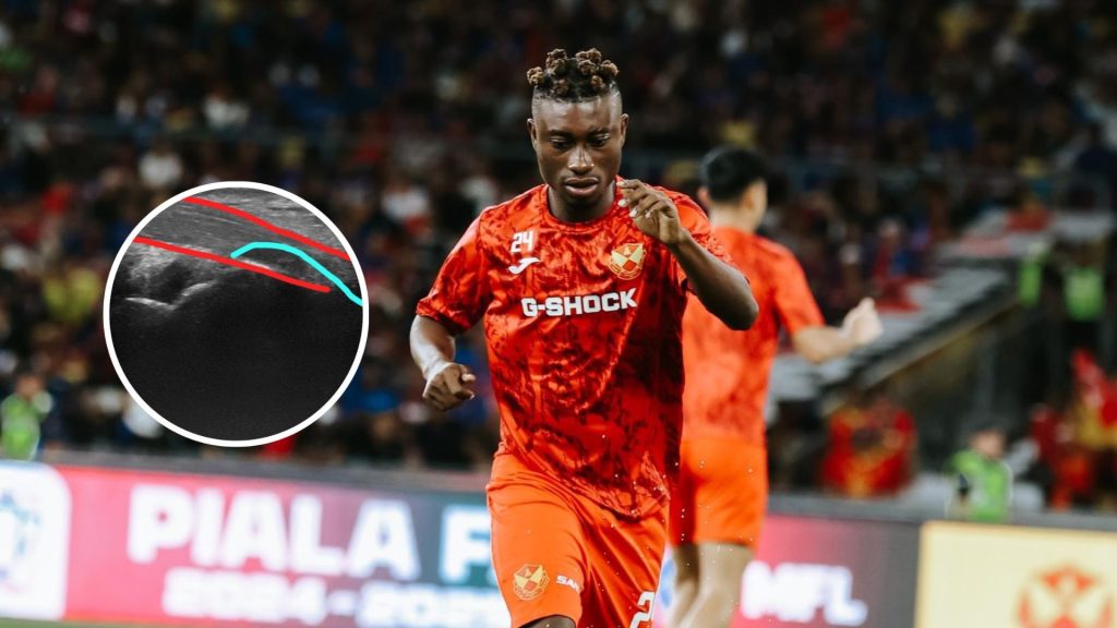 Situasi Alex Agyarkwa Resahkan Selangor