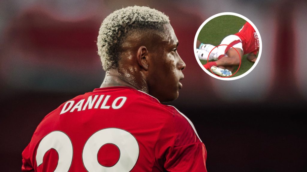 Pemain Nottingham Forest Patah Kaki Selepas Beraksi 7 Minit