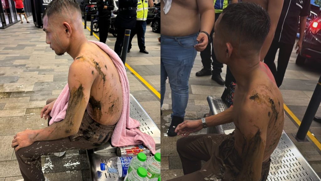 Kesedihan Faisal Halim Disiram Air Keras: Apa Salah Saya?